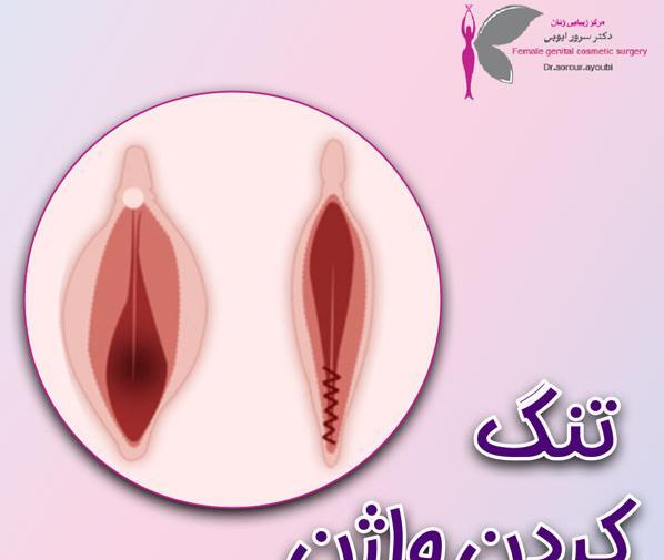عکس های واقعی عمل لابیاپلاستی اهواز، استان خوزستان