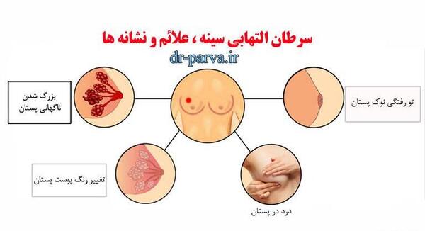 عکس سرطان سینه