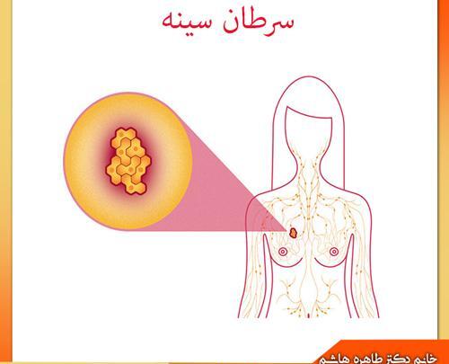 عکس سرطان سینه