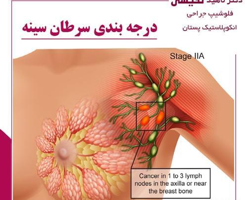 عکس سرطان سینه