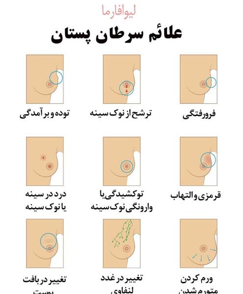 عکس سرطان سینه