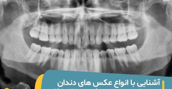 عکس دندانپزشکی
