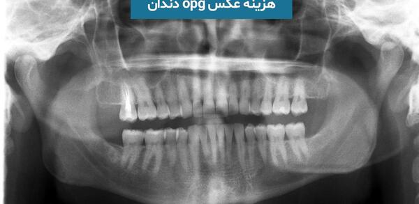 عکس دندانپزشکی