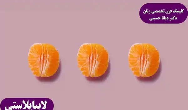 عکس های واقعی عمل لابیاپلاستی مشهد استان خراسان رضوی ایران