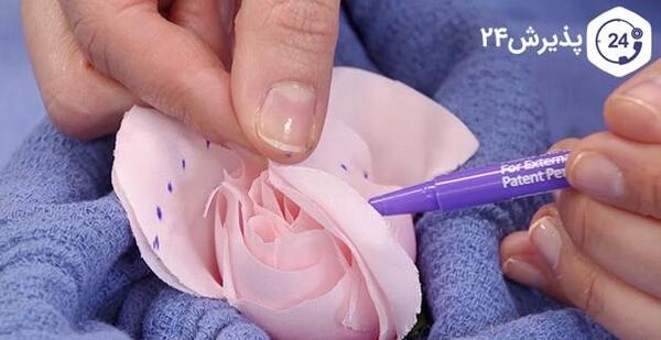عکس های واقعی عمل لابیاپلاستی مشهد استان خراسان رضوی ایران