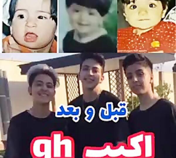 عکس های قبل عمل شکیب غلامی
