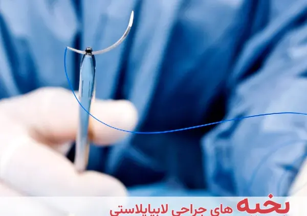 بخیه زیبایی عکس های واقعی عمل لابیاپلاستی