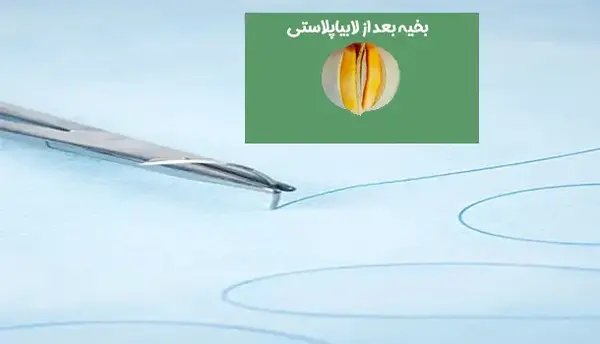 بخیه زیبایی عکس های واقعی عمل لابیاپلاستی