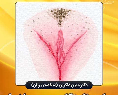 بخیه زیبایی عکس های واقعی عمل لابیاپلاستی