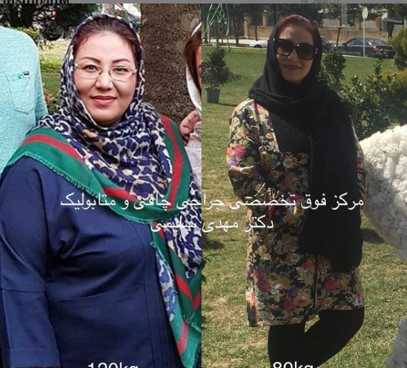 عکس های قبل و بعد از لاغری