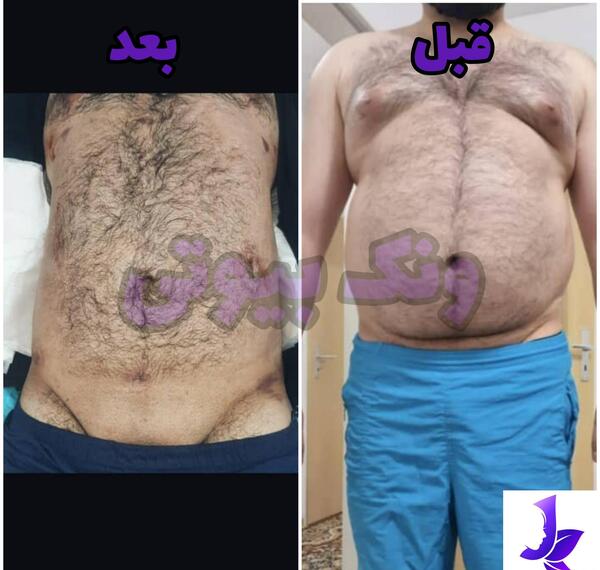 عکس های قبل و بعد از لاغری