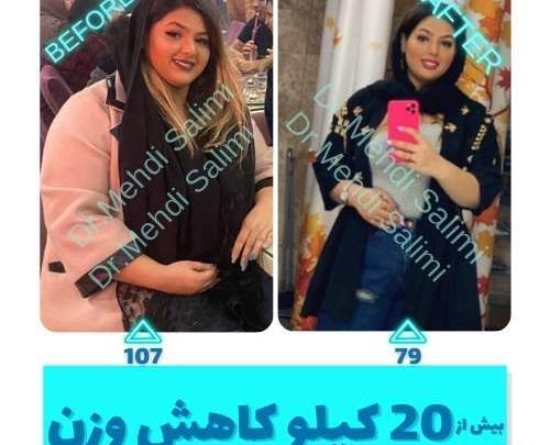 عکس های قبل و بعد از لاغری