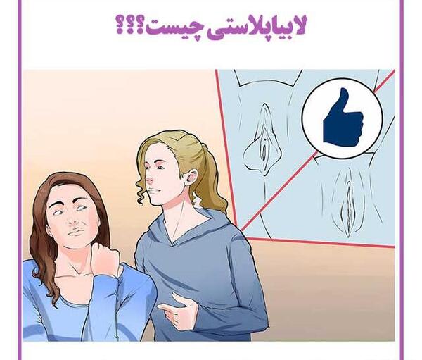 برداشتن لابيا عکس های واقعی عمل لابیاپلاستی