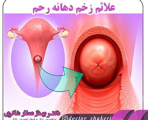 عکس عفونت رحم