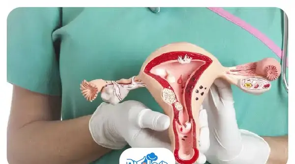 عکس عفونت رحم
