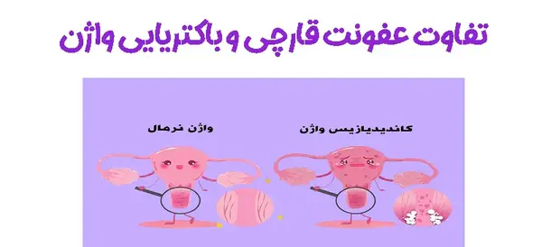 عکس عفونت رحم