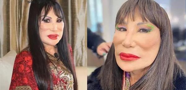 عکس های طلا خواننده