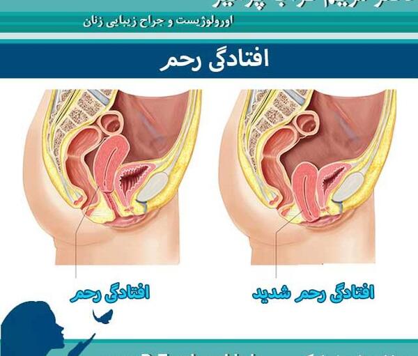 عکس رحم طبیعی