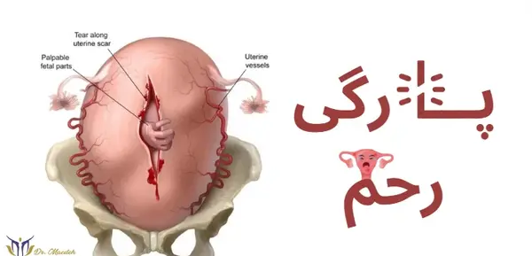 عکس رحم طبیعی
