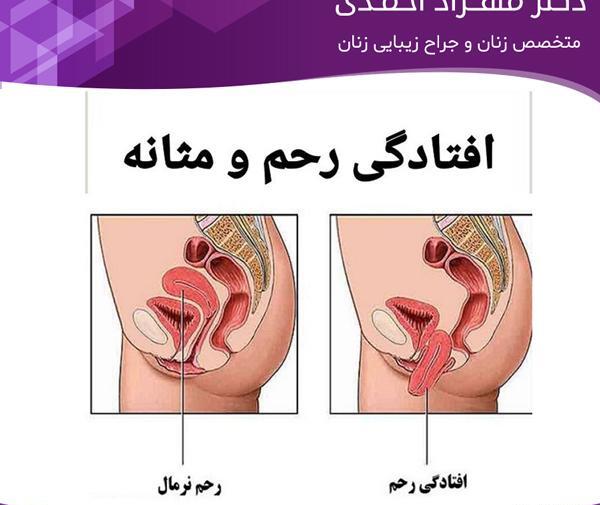 عکس رحم طبیعی