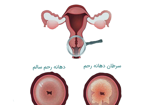 عکس رحم طبیعی