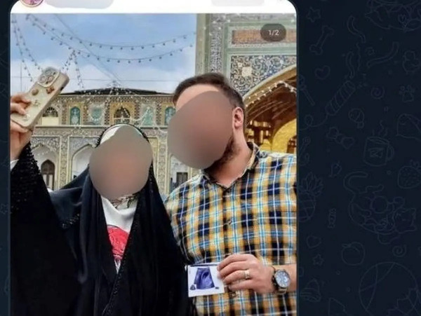 عکس رحم طبیعی