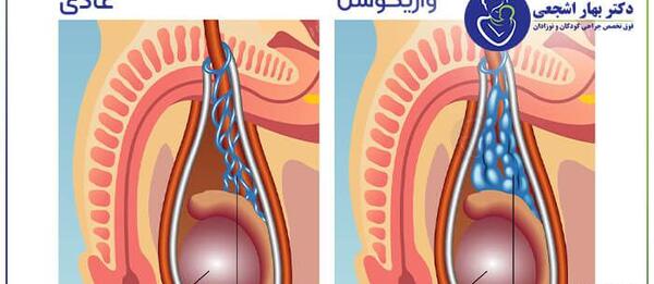 عکس بیضه سالم و ناسالم