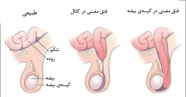 عکس بیضه سالم و ناسالم