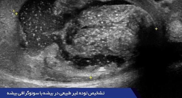 عکس بیضه سالم و ناسالم