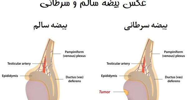 عکس بیضه سالم و ناسالم