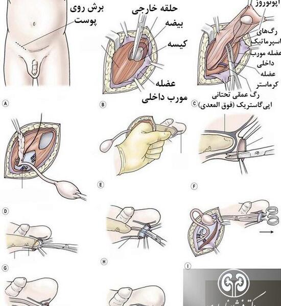 عکس بیضه سالم و ناسالم