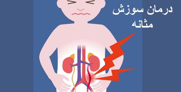 عکس قرص سوزش ادرار