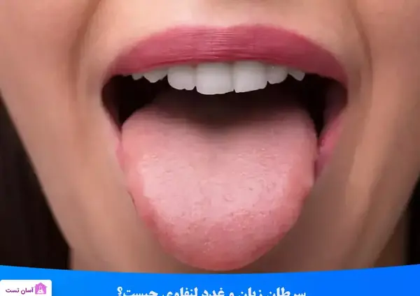 عکس زبان سرطانی