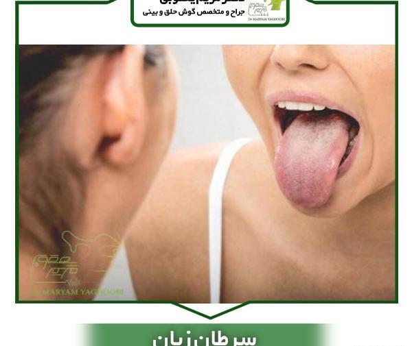عکس زبان سرطانی