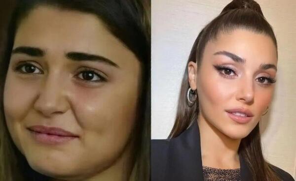 عکس های چاقی هانده ارچل