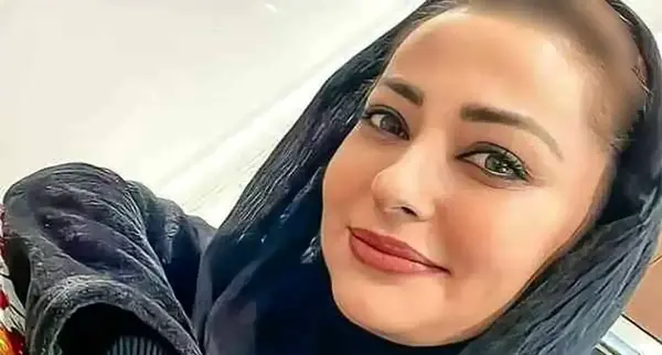 عکس های چاقی هانده ارچل