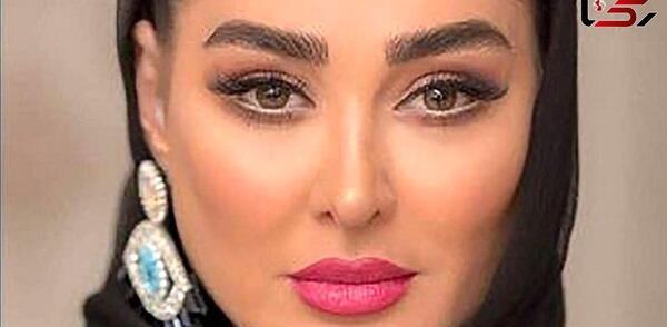 عکس های چاقی هانده ارچل