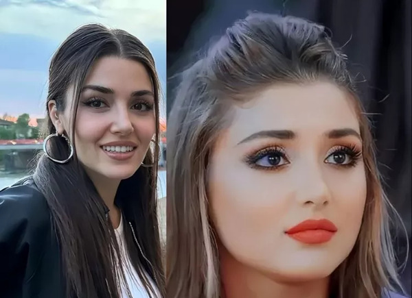 عکس های چاقی هانده ارچل