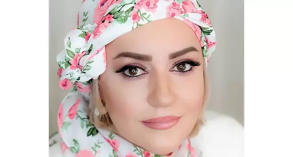 عکس های چاقی هانده ارچل