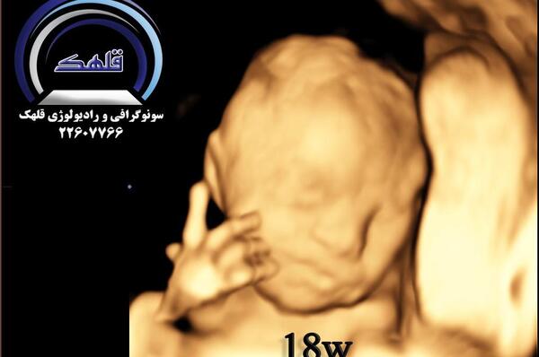 عکس های سه بعدی جنین