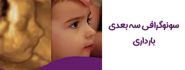 عکس های سه بعدی جنین