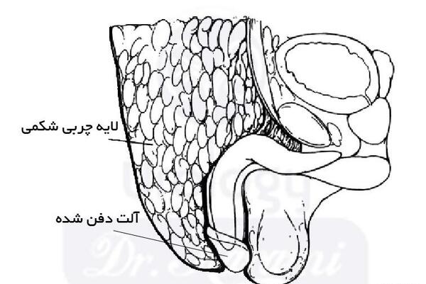 عکس آلت تناسلی