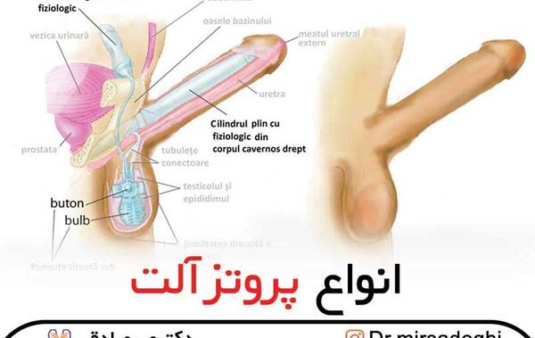 عکس آلت تناسلی