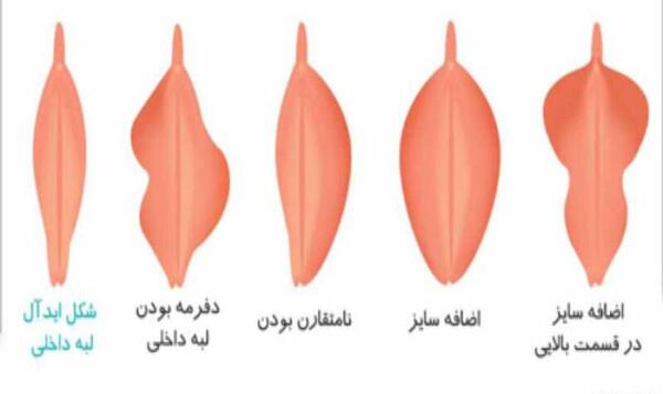 عکس آلت تناسلی