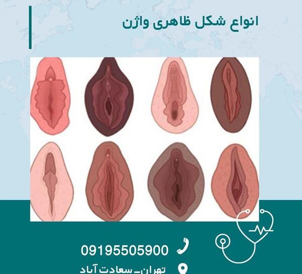 عکس آلت تناسلی