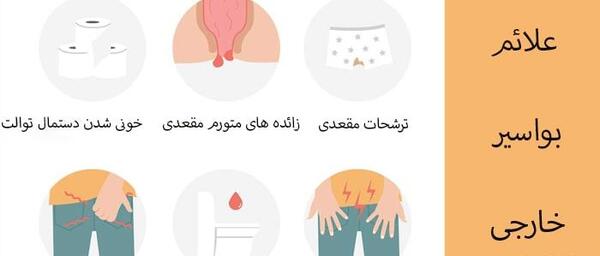 عکس بواسیر خارجی