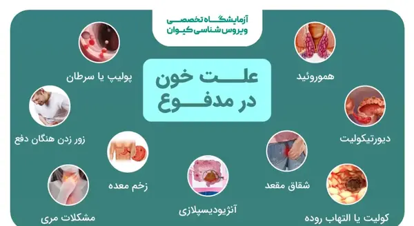 عکس مدفوع سیاه رنگ