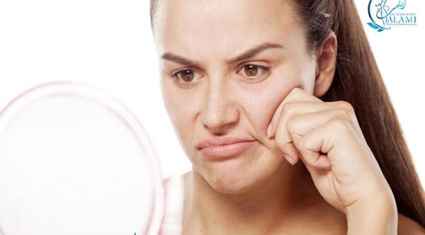 عکس قرص های چاقی صورت