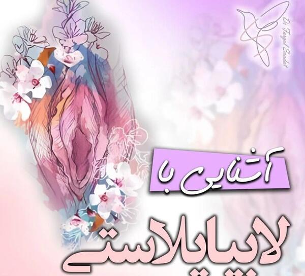 عکس های واقعی عمل لابیاپلاستی تهران، استان تهران، ایران