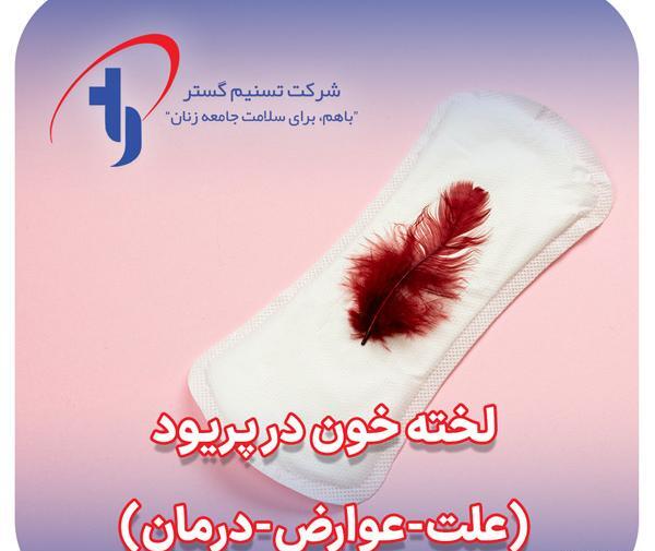 عکس کیست دفع شده در پریودی